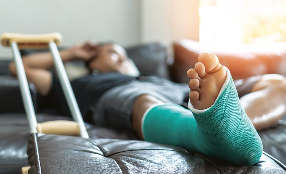 Man lying on couch with a green cast on leg